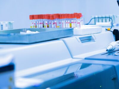 Jak często robić podstawowe badania krwi po 30., 40. i 50. roku życia informacje